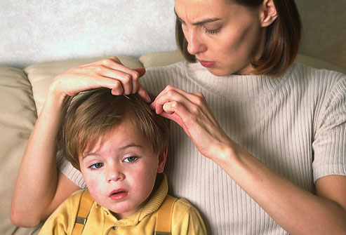 Обнаружение вшей у ребенка при ручном осмотре головы в домашних условиях